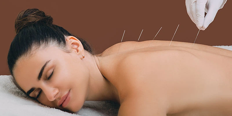 acupuncture-img2